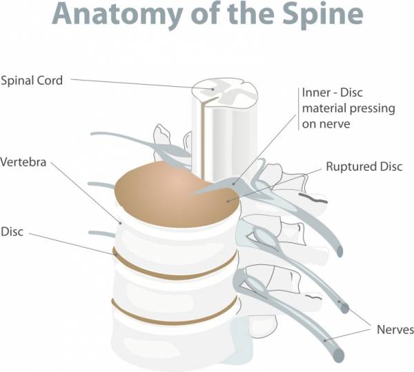 low back pain, lower back injury, low back injury, lumbar pain, lumbar injury