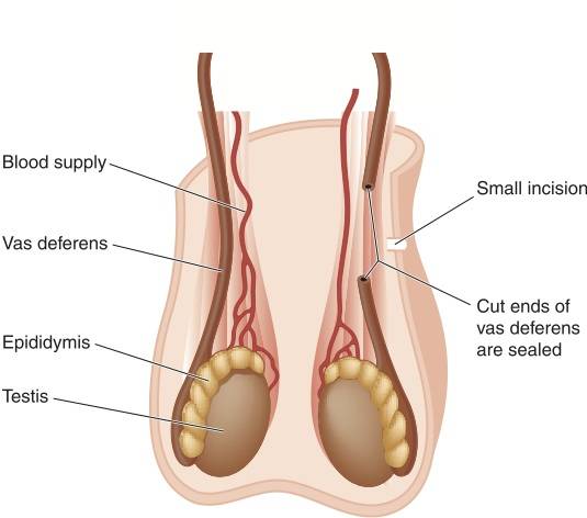 birth control, athletes and birth control, female fitness, female hormones