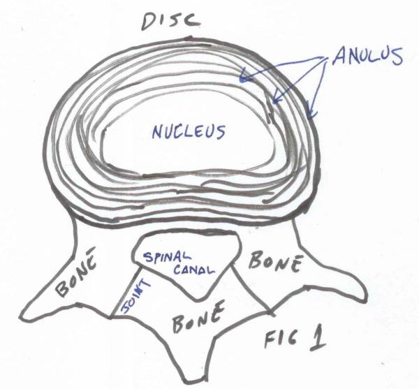 back pain, herniated disc, slipped disc, anatomy, spine anatomy, back pain