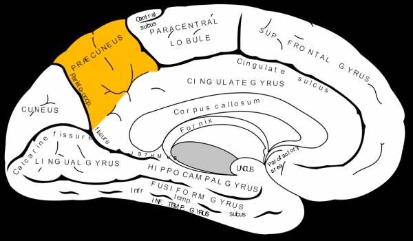 Fibromyalgia, special populations, precuneus, frontal lobe, medulla