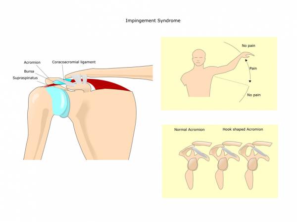 The shoulder joint is one of the most vulnerable joints in the human body.