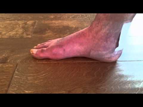 Foot Arch Demo