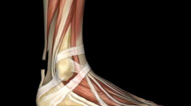 tendon, achilles tendon, tendon injury