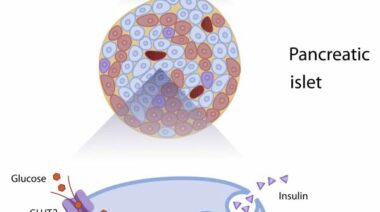 insulin, insulin response, metabolic disease, metabolic flexibility, glucose