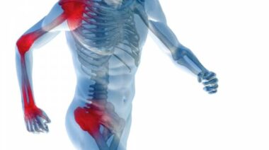 inflammation, anti-inflammatory, anti-inflammatory diet, inflammation diet