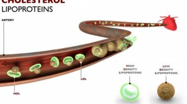 lipoproteins, HDL, LDL, cholesterol