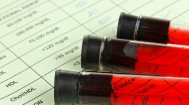 ben greenfield, blood tests, blood tests for athletes, athletes and blood tests